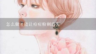 怎么做才能让痘痘粉刺消失