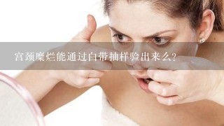 宫颈糜烂能通过白带抽样验出来么？