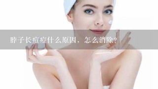 脖子长痘痘什么原因，怎么消除？