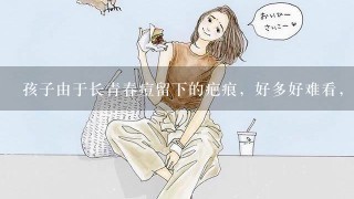 孩子由于长青春痘留下的疤痕，好多好难看，怎么办呢?