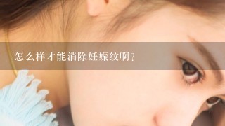 怎么样才能消除妊娠纹啊？