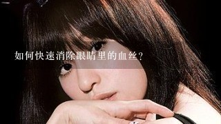 如何快速消除眼睛里的血丝?