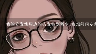 我的分发线周边的头发特别稀少,我想问问专家能治