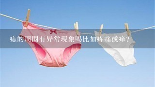 痣的周围有异常现象吗比如疼痛或痒