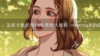 怎样才能识别yadh里的大规模 veroorza者的症状?